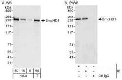 SMCHD1 Antibody, Novus Biologicals 0.1mL; Unlabeled:Antibodies, Polyclonal