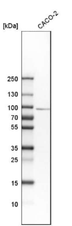 SMCR8 Antibody, Novus Biologicals 0.1mL; Unlabeled:Antibodies, Polyclonal