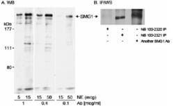 SMG1 Antibody, Novus Biologicals 0.1mg; Unlabeled:Antibodies, Polyclonal