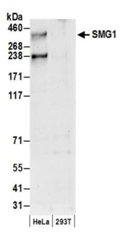 SMG1 Antibody, Novus Biologicals 0.1mg; Unlabeled:Antibodies, Polyclonal