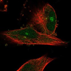 SMG6 Antibody, Novus Biologicals 0.1mL; Unlabeled:Antibodies, Polyclonal