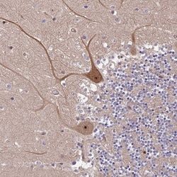 SMG6 Antibody, Novus Biologicals 0.1mL; Unlabeled:Antibodies, Polyclonal