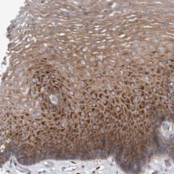 SMG7 Antibody, Novus Biologicals 0.1mL; Unlabeled:Antibodies, Polyclonal