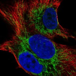 SMIM12 Antibody, Novus Biologicals 0.1mL; Unlabeled:Antibodies, Polyclonal