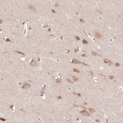 SMIM13 Antibody, Novus Biologicals 25 &mu;L, Unlabeled:Antibodies, Polyclonal