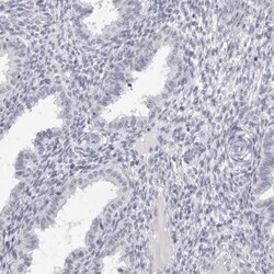 SMIM2 Antibody, Novus Biologicals 25 &mu;L; Unlabeled:Antibodies, Polyclonal
