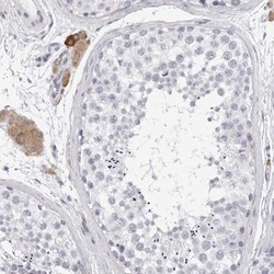 SMIM2 Antibody, Novus Biologicals 25 &mu;L; Unlabeled:Antibodies, Polyclonal