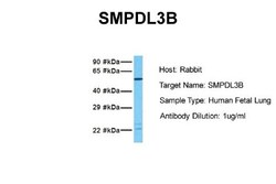 SMPDL3B Antibody, Novus Biologicals 0.05mg; Unlabeled:Antibodies, Polyclonal