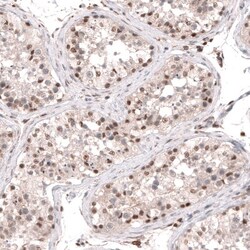 SMYD2 Antibody, Novus Biologicals:Antibodies:Primary Antibodies