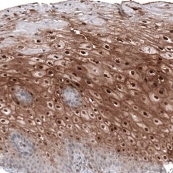 SMYD2 Antibody, Novus Biologicals:Antibodies:Primary Antibodies