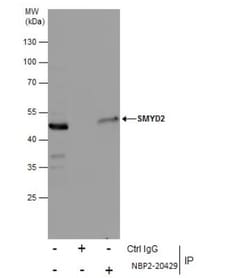 SMYD2 Antibody, Novus Biologicals 0.1mL; Unlabeled:Antibodies