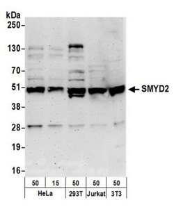 SMYD2 Antibody, Novus Biologicals 0.1mg; Unlabeled:Antibodies, Polyclonal