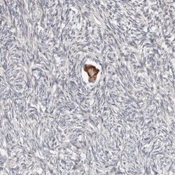SMYD4 Antibody, Novus Biologicals 0.1mL; Unlabeled:Antibodies, Polyclonal