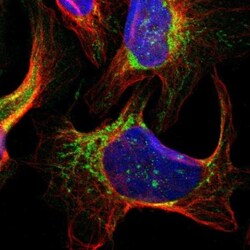 SMYD5 Antibody, Novus Biologicals:Antibodies:Primary Antibodies