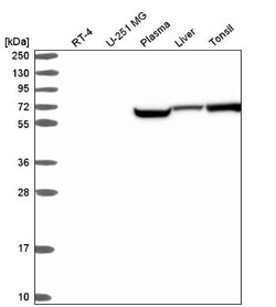 SMYD5 Antibody, Novus Biologicals 0.1mL; Unlabeled:Antibodies, Polyclonal