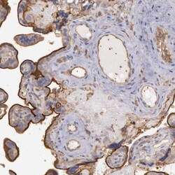 SNAP23 Antibody, Novus Biologicals:Antibodies:Primary Antibodies