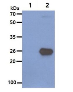 SNAP25 Antibody (4E11) - BSA Free, Novus Biologicals 0.1mL; Unlabeled:Antibodies,