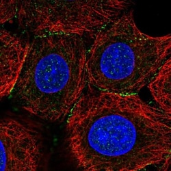 SNAP25 Interacting Protein Antibody, Novus Biologicals:Antibodies:Primary
