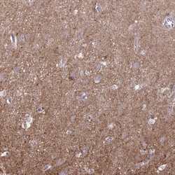 SNAP25 Interacting Protein Antibody, Novus Biologicals:Antibodies:Primary