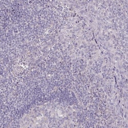 SNAP25 Interacting Protein Antibody, Novus Biologicals:Antibodies:Primary