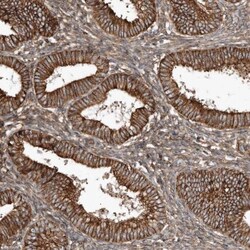 SNAP47 Antibody, Novus Biologicals 0.1mL; Unlabeled:Antibodies, Polyclonal