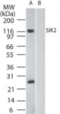 SNF1LK2/SIK2 Antibody, Novus Biologicals:Antibodies:Primary Antibodies