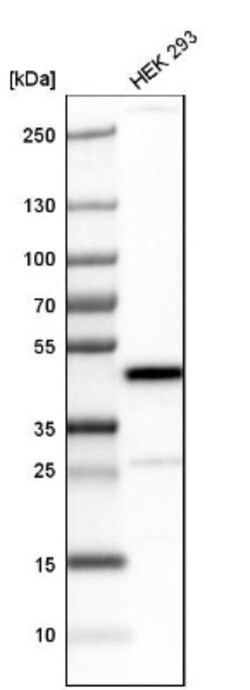 SNF5 Antibody, Novus Biologicals 0.1mL; Unlabeled:Antibodies, Polyclonal