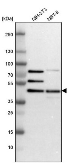 SNF5 Antibody, Novus Biologicals 0.1mL; Unlabeled:Antibodies, Polyclonal