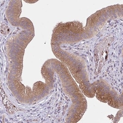 SNF8 Antibody, Novus Biologicals 25 &mu;L, Unlabeled:Antibodies, Polyclonal