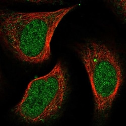 SNIP1 Antibody, Novus Biologicals 0.1mL; Unlabeled:Antibodies, Polyclonal