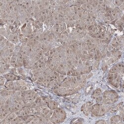 SNIP1 Antibody, Novus Biologicals 0.1mL; Unlabeled:Antibodies, Polyclonal