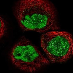 SNM1 Antibody, Novus Biologicals 0.1mL; Unlabeled:Antibodies, Polyclonal