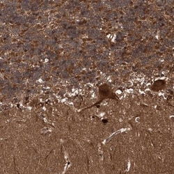 SNRNP25 Antibody, Novus Biologicals:Antibodies:Primary Antibodies
