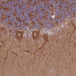 SNRNP25 Antibody, Novus Biologicals 0.1mL; Unlabeled:Antibodies, Polyclonal