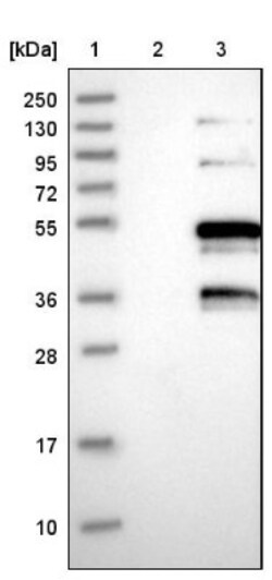 ATE1 Antibody, Novus Biologicals:Antibodies:Primary Antibodies