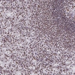 SNRP70 Antibody, Novus Biologicals 25 &mu;L, Unlabeled:Antibodies, Polyclonal