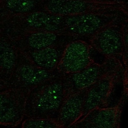 SNRPA1 Antibody, Novus Biologicals:Antibodies:Primary Antibodies