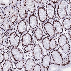 SNRPA1 Antibody, Novus Biologicals:Antibodies:Primary Antibodies
