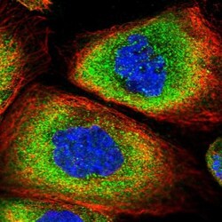 SNRPD2 Antibody, Novus Biologicals 0.1mL; Unlabeled:Antibodies, Polyclonal