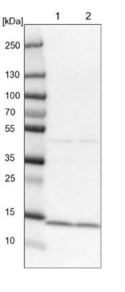SNRPD2 Antibody, Novus Biologicals 0.1mL; Unlabeled:Antibodies, Polyclonal