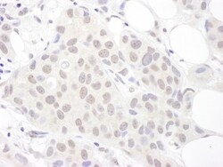 SNRPD3 Antibody, Novus Biologicals 0.1mg; Unlabeled:Antibodies, Polyclonal