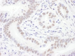 SNRPD3 Antibody, Novus Biologicals 0.1mg; Unlabeled:Antibodies, Polyclonal