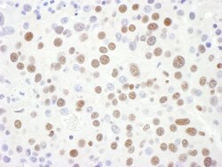 SNRPD3 Antibody, Novus Biologicals 0.1mg; Unlabeled:Antibodies, Polyclonal