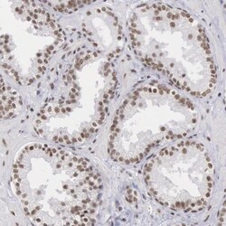 SNRPD3 Antibody, Novus Biologicals 25ul | Buy Online | Novus Biologicals | Fisher Scientific