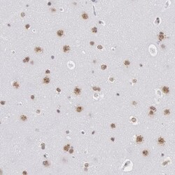 SNRPD3 Antibody, Novus Biologicals 25ul | Buy Online | Novus Biologicals | Fisher Scientific