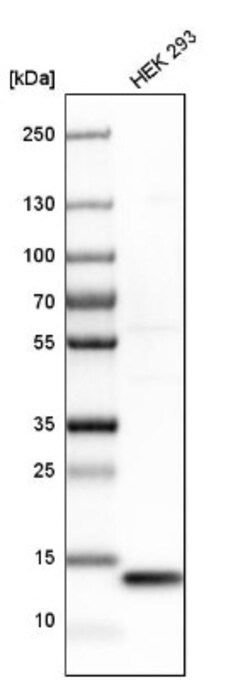 SNRPD3 Antibody, Novus Biologicals 25ul | Buy Online | Novus Biologicals | Fisher Scientific