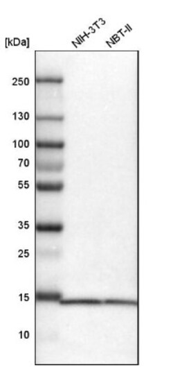 SNRPD3 Antibody, Novus Biologicals 25ul | Buy Online | Novus Biologicals | Fisher Scientific