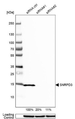 SNRPD3 Antibody, Novus Biologicals 25ul | Buy Online | Novus Biologicals | Fisher Scientific