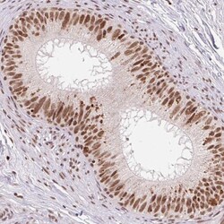 SNRPG Antibody, Novus Biologicals 25 &mu;L, Unlabeled:Antibodies, Polyclonal