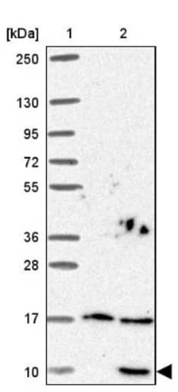 SNRPG Antibody, Novus Biologicals 25 &mu;L, Unlabeled:Antibodies, Polyclonal